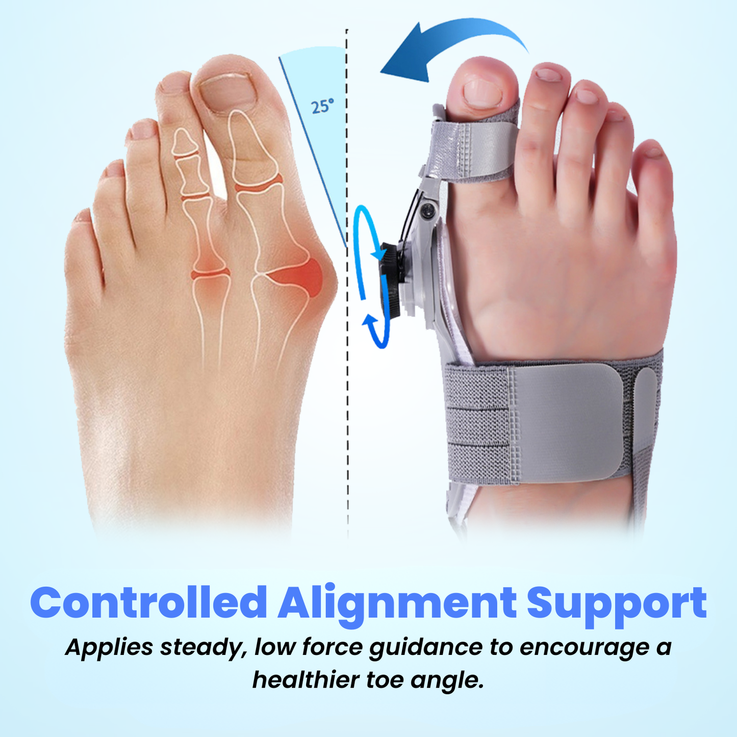 TrueAlign™ Bunion Corrector